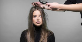 Here Is All You Need to Know About Why You Have Dandruff